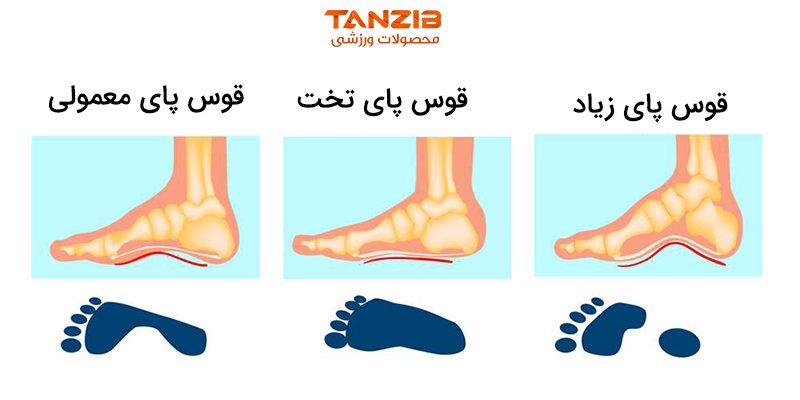 توضیح انواع قوس پا با عکس و نوشته با لوگوی تن زیب برای مقاله  پوشیدن کفش مناسب حین ورزش